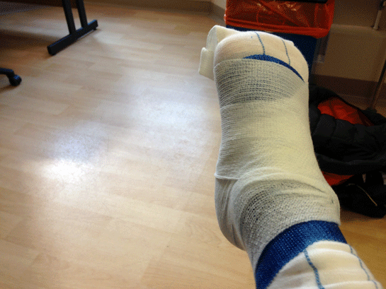 Bandaged-Foot